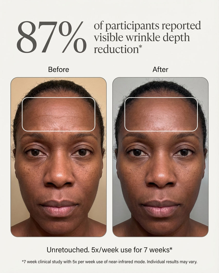 GlowVital OmniGlow vs CurrentBody Skin LED Mask: Is the £400 Mask Worth It?