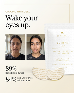 Dark Circles Under the Eyes: Causes and What Helps