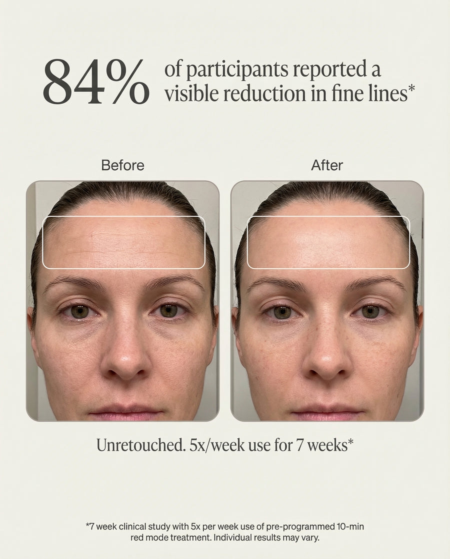 Visibly softer fine lines