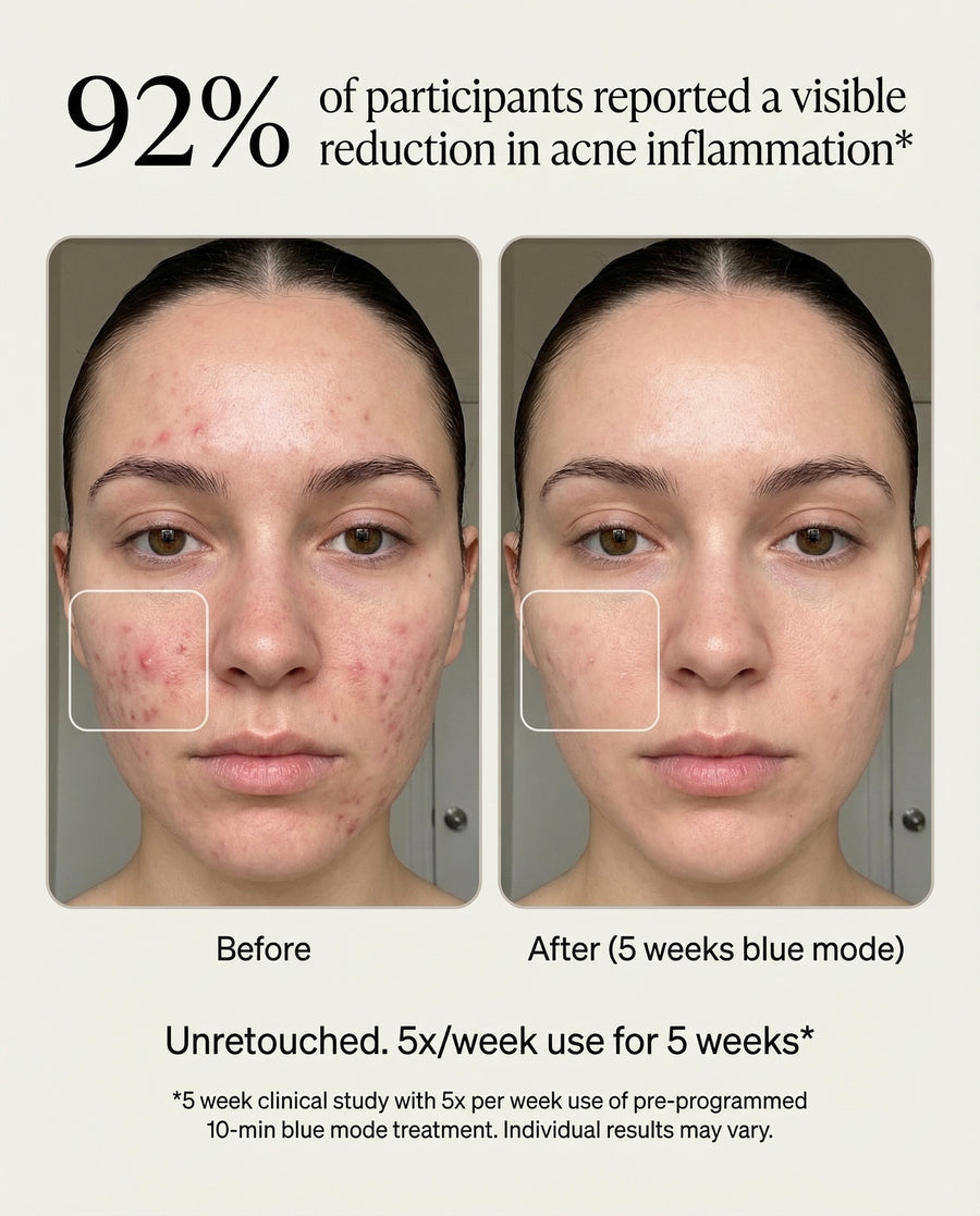Clearer, calmer complexion