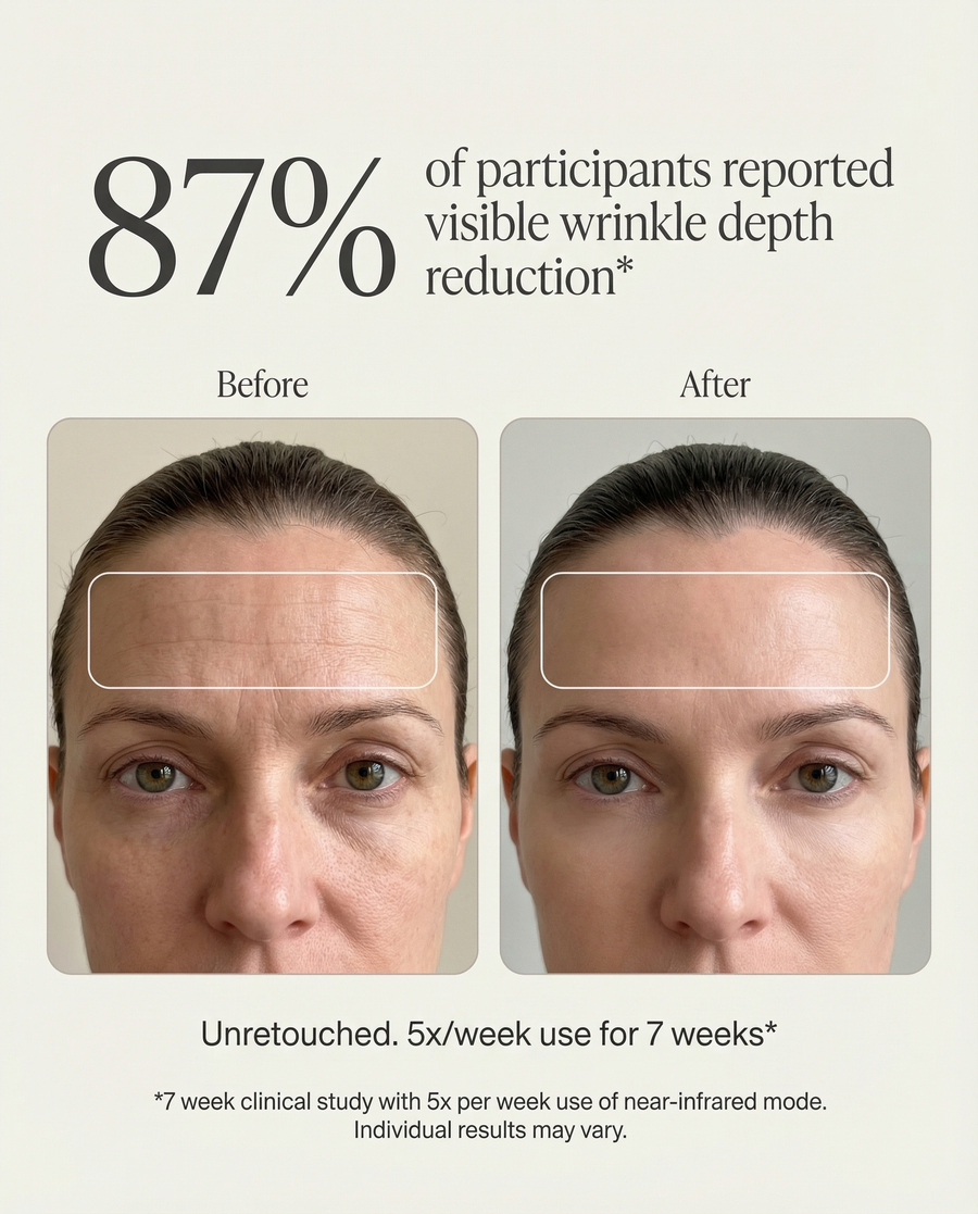 Smoother, firmer looking skin